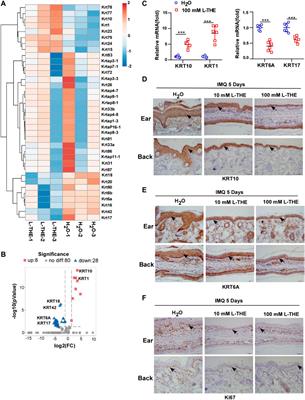 L-Theanine Alleviates IMQ-Induced Psoriasis Like Skin Inflammation by Downregulating the Production of IL-23 and Chemokines